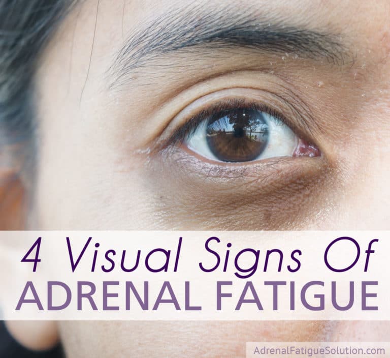 4 Visual Signs That You Could Have Adrenal Fatigue