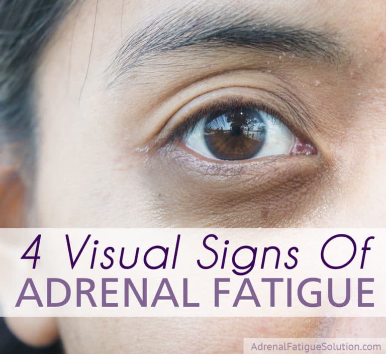 4-visual-signs-that-you-could-have-adrenal-fatigue